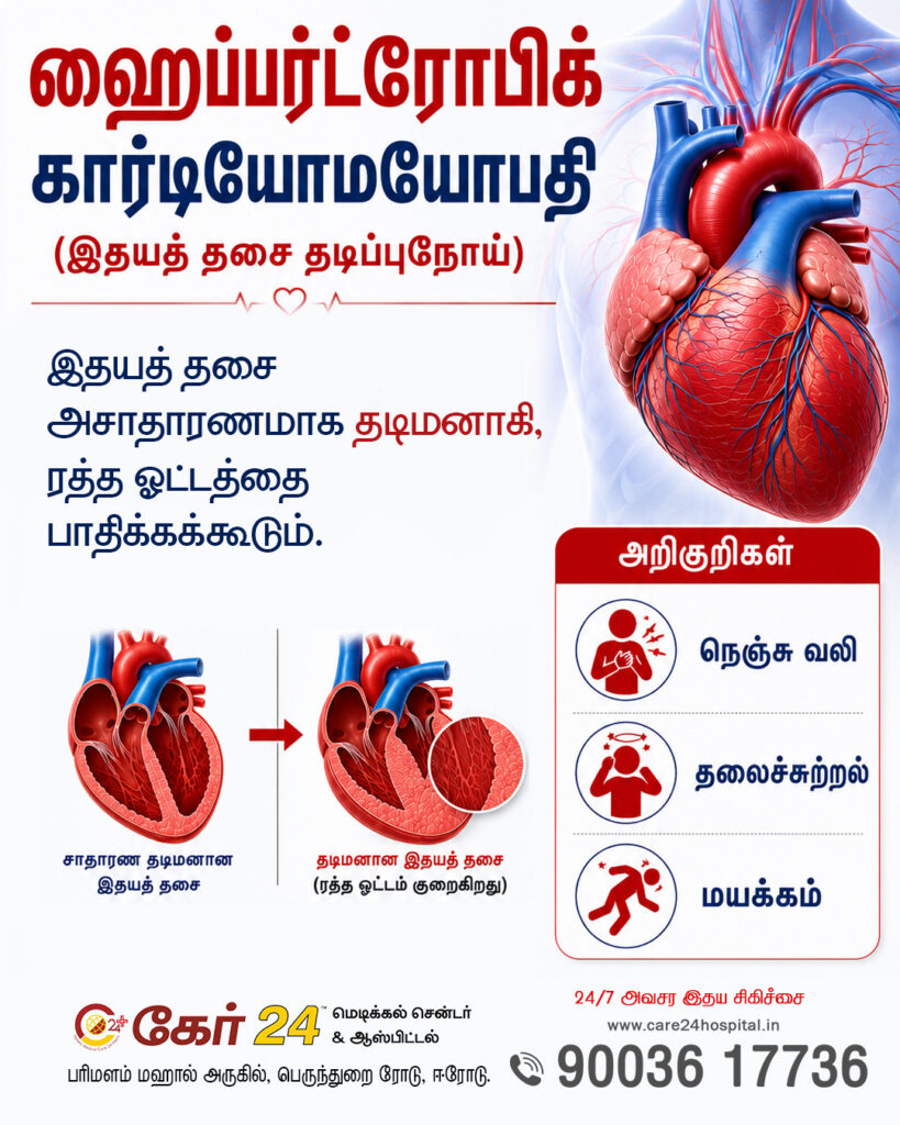 Hypertrophic Cardiomyopathy