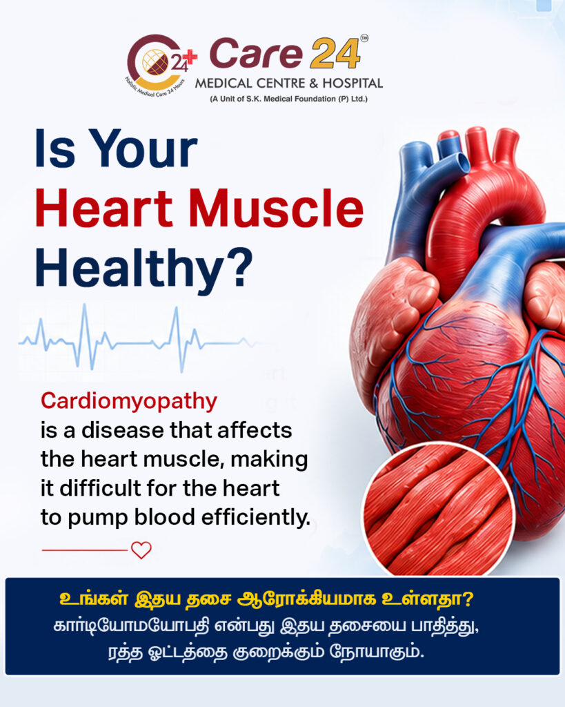 expert treatment for cardiomyopathy in Erode?