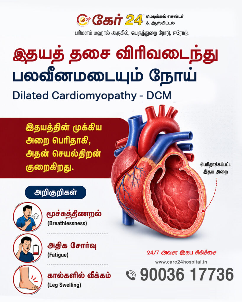 Dilated Cardiomyopathy treatment at Care 24 Hospital, Erode